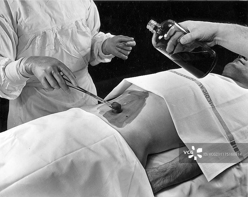 医学，卫生，胃部手术，大约1940年，具体位置不详，德国，欧洲图片素材