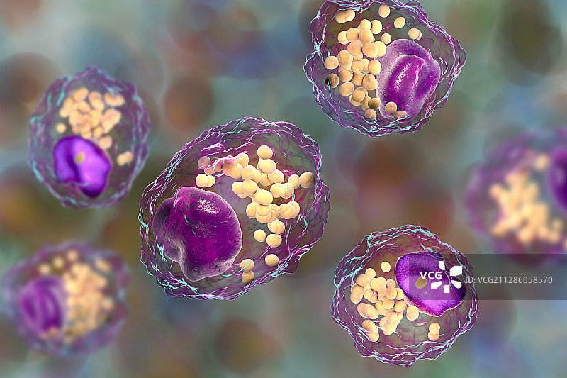 巨噬细胞泡沫细胞，图示图片素材