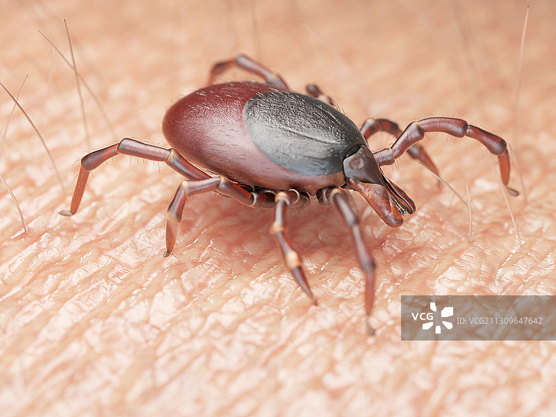 蜱虫在人类皮肤上爬行的插图图片素材