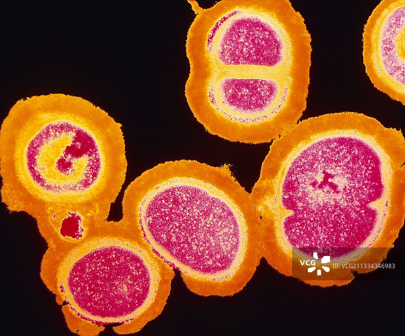 耐MRSA葡萄球菌图片素材