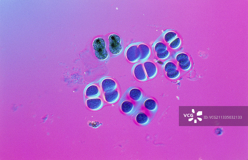 蓝绿色藻类,Chroococcus图片素材