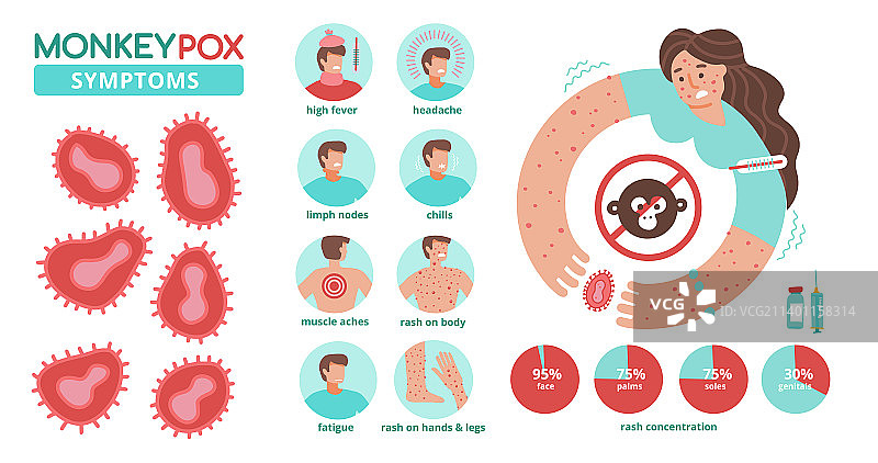 猴痘病毒新症状信息图图片素材