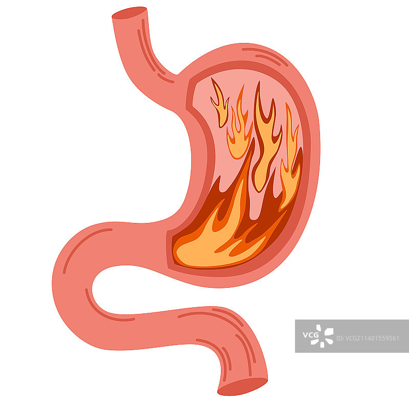 人的胃着火不健康的胃概念图片素材