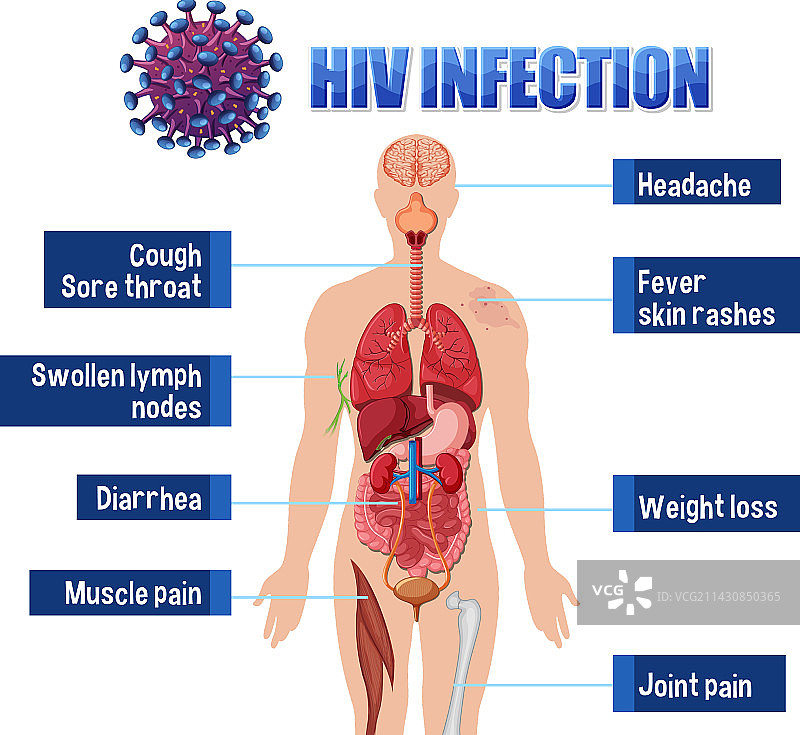 艾滋病感染的信息海报图片素材
