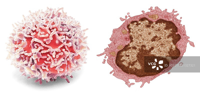淋巴细胞，SEM-TEM比较图片素材