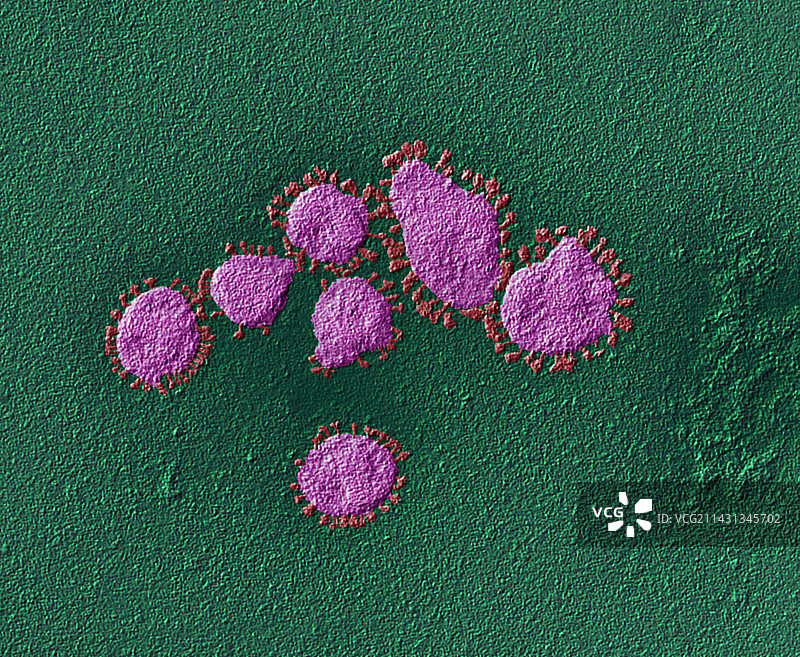 冠状病毒颗粒，透射电镜图片素材