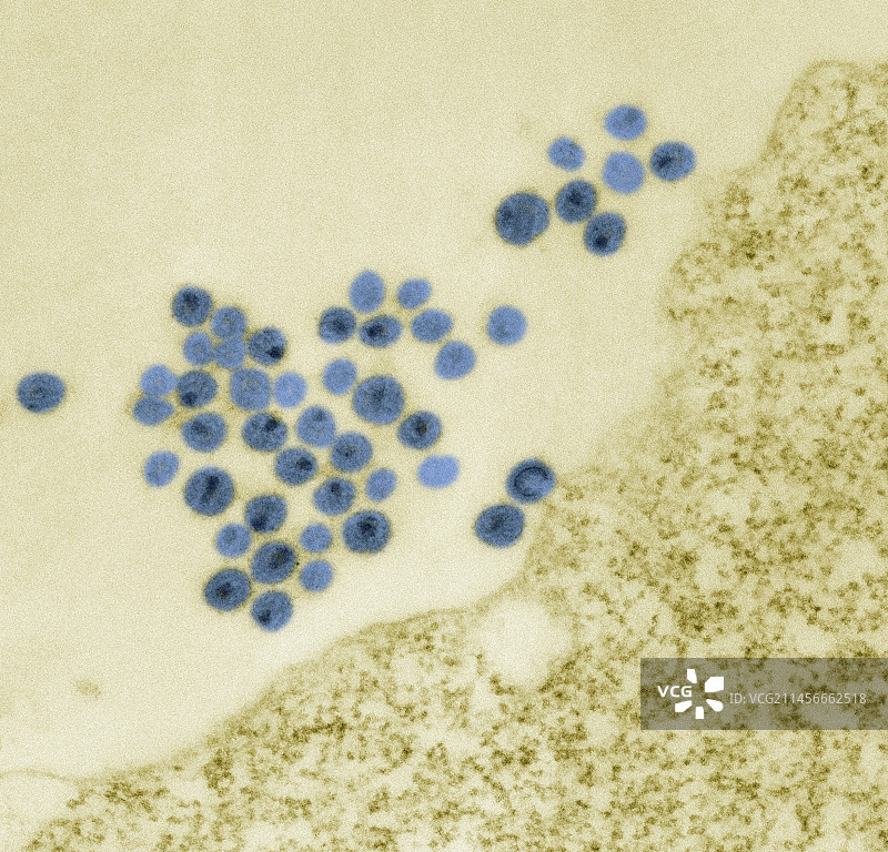 细胞表面的HIV颗粒，透射电镜图片素材