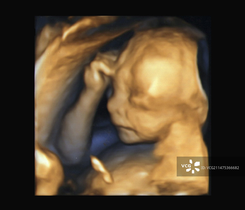 胎儿20周，3D超声扫描图片素材