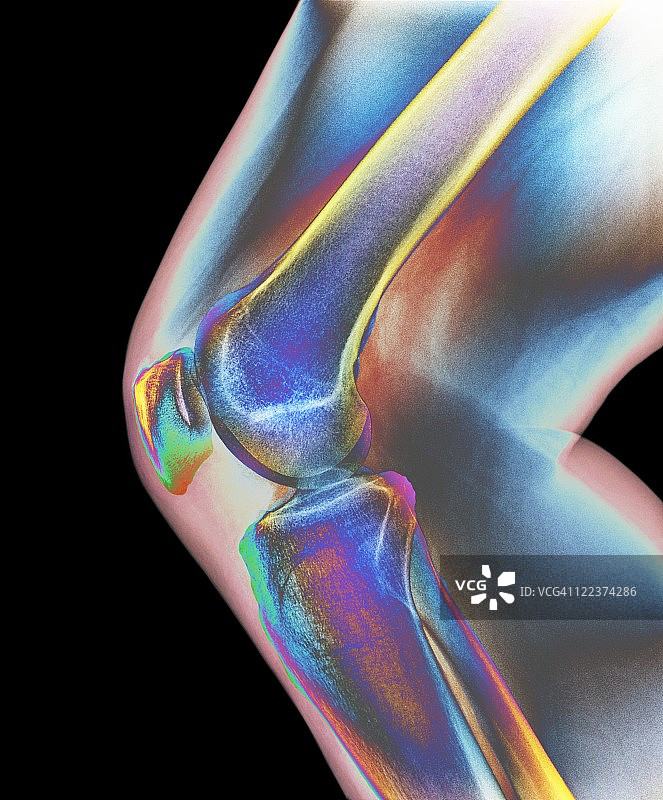 正常的膝盖,x射线图片素材