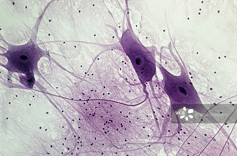 神经元(运动)，脊髓，50X, 35mm。显示:3个神经元、细胞体、细胞核、树突、可能轴突和神经胶质细胞。图片素材