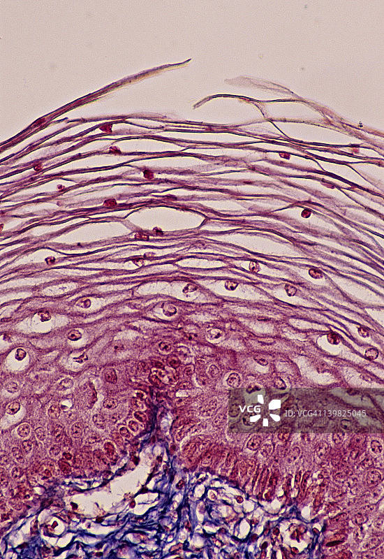 层状鳞状上皮(阴道，无角化)100x该上皮有多层(或多层)，表面附近的细胞非常扁平(鳞状)。下面也显示支持结缔组织。图片素材