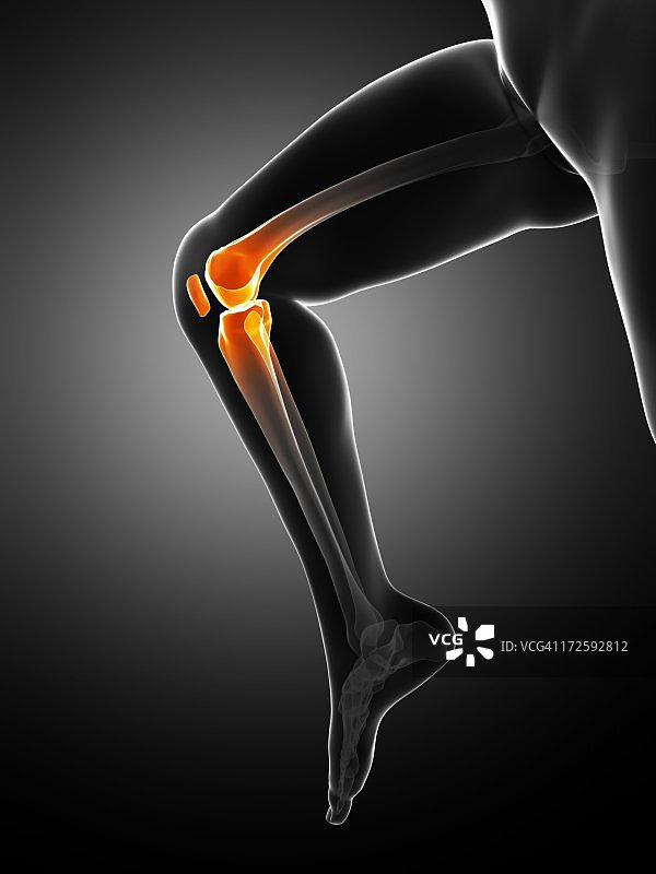 膝盖疼痛，概念艺术品图片素材
