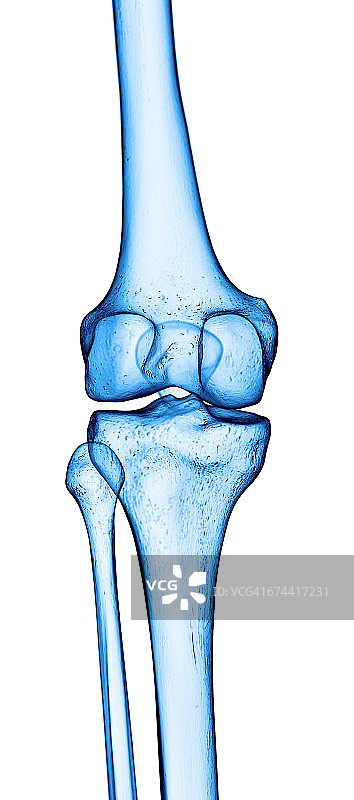 人工膝关节图片素材
