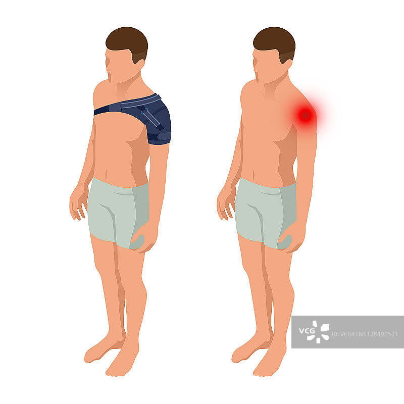 肩关节疼痛或扭伤。人体解剖结构。外伤后康复。整形外科和医学。等距矢量图图片素材