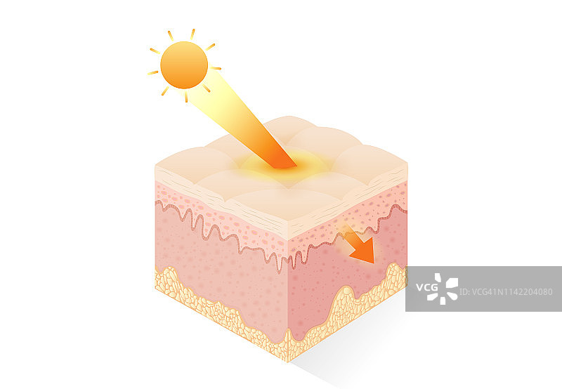 阳光中的紫外线能穿透人体皮肤深处。图片素材