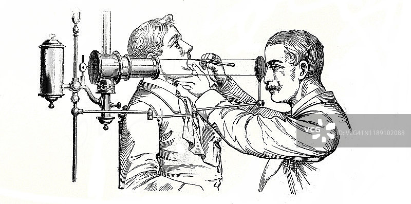 医生用一种特殊装置检查病人的喉咙图片素材