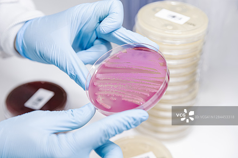 科学家检查培养皿中微生物的生长图片素材