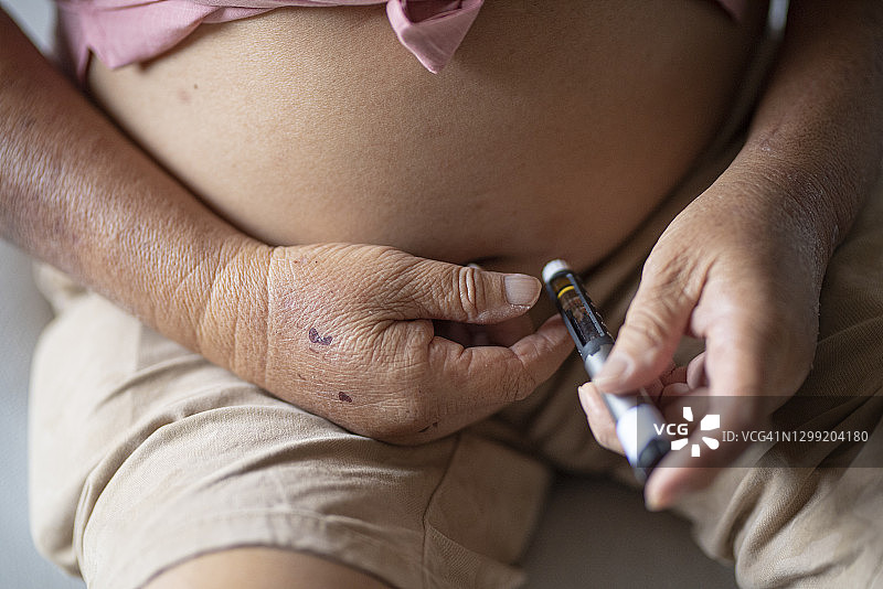 亚洲华人老人，每天将注射器胰岛素注射到他的腹部图片素材