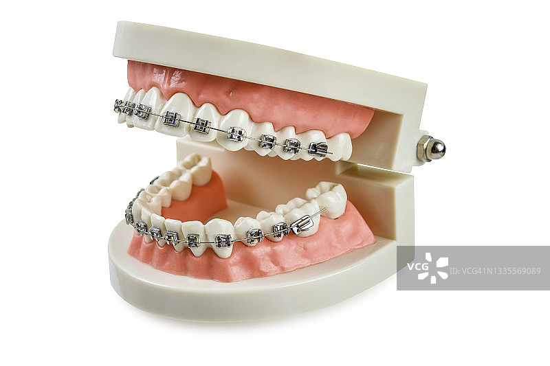 牙齿模型分离在白色背景上。图片素材