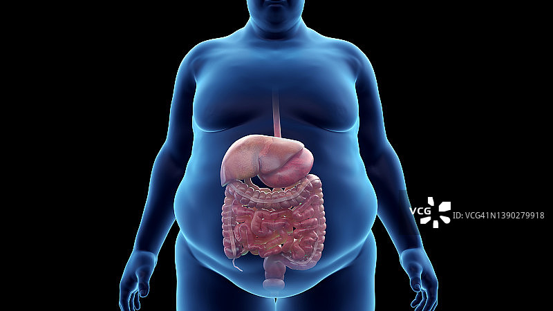 肥胖男子的消化系统，插图图片素材
