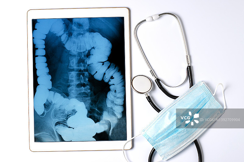 胃肠道的x光片。远程医疗和疾病诊断的概念图片素材