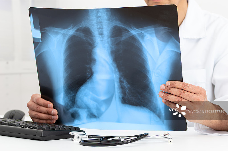 医生检查病人肺部的x光片图片素材