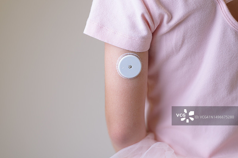 儿童手臂上的血糖传感器用于远程测量血糖水平图片素材