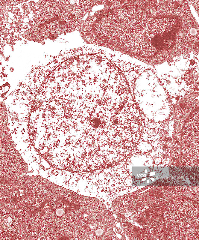 用透射电子显微镜拍摄位于单层细胞培养中心的一个死细胞图片素材