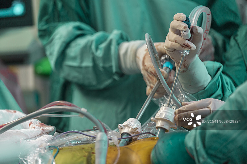 腹腔镜手术。外科医生用腹腔镜做手术图片素材