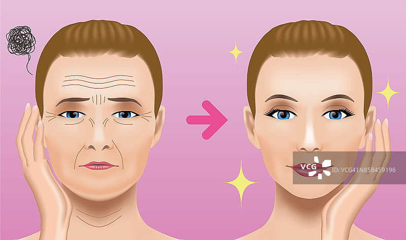 面部皱纹治疗前后。整容手术。女性面部护理理念。图片素材