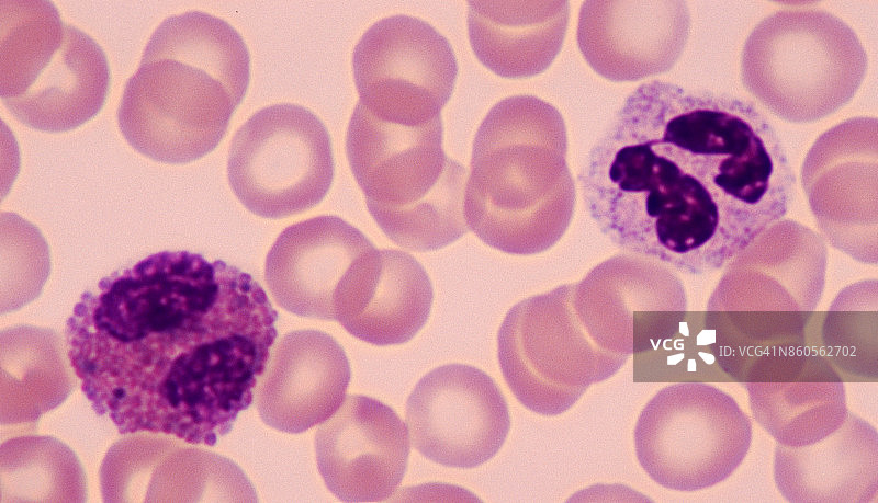 2个白细胞或白细胞-中性粒细胞(右)和嗜酸性粒细胞(左)，人血涂片，500X图片素材