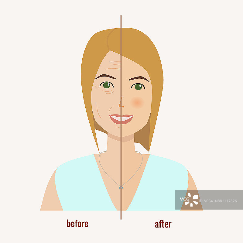 一个女人在面部护理前后的脸。嫩肤的概念。胶原蛋白。整容手术图片素材