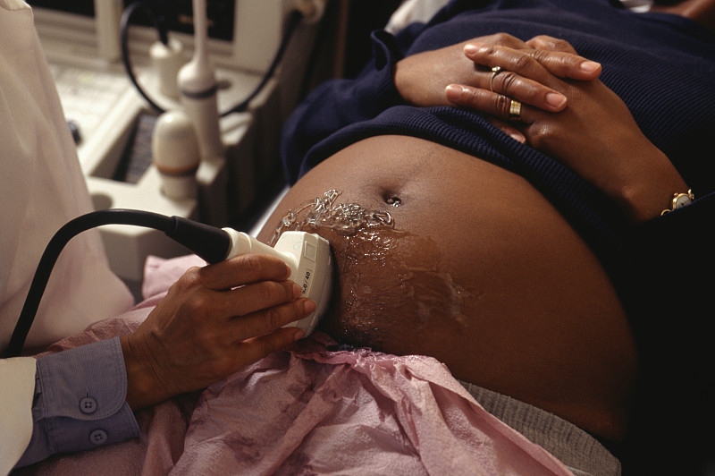 正在做超声波检查的孕妇，腹部图片下载