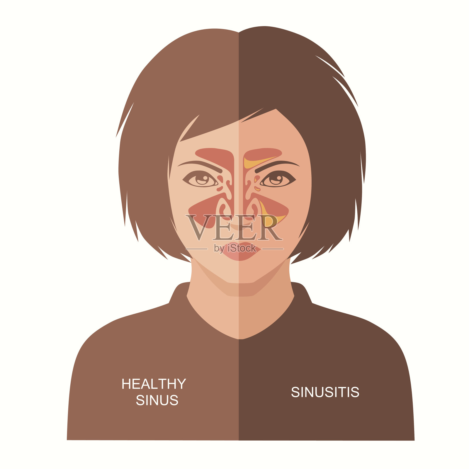 鼻窦炎的疾病,插画图片素材