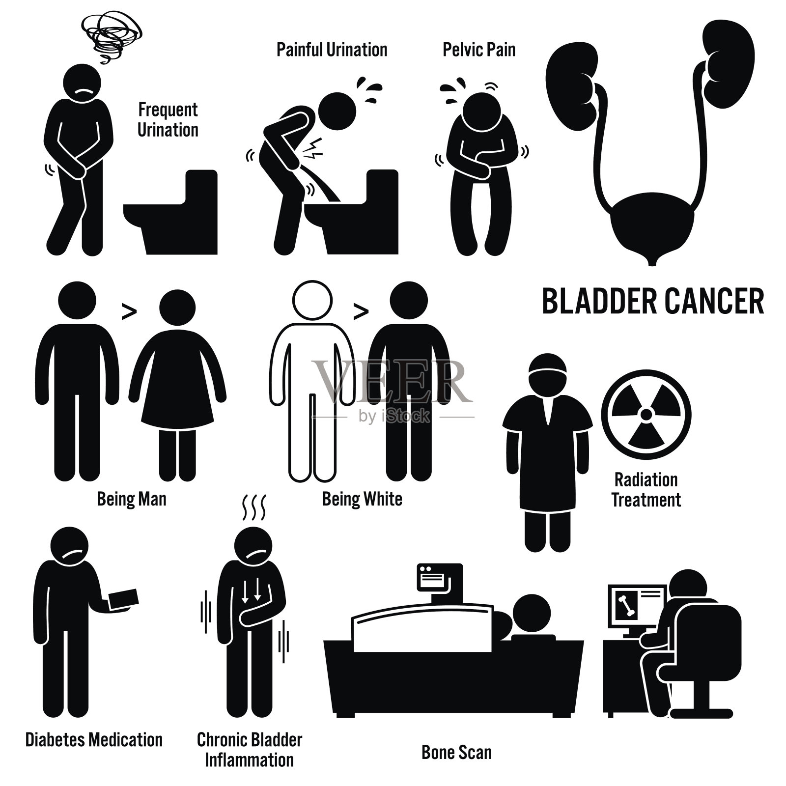 膀胱癌的插图插画图片素材