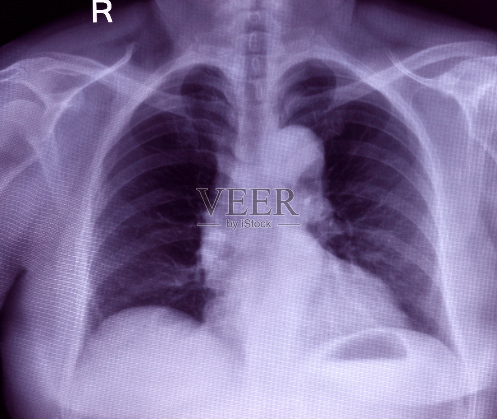 胸部x光图像照片摄影图片
