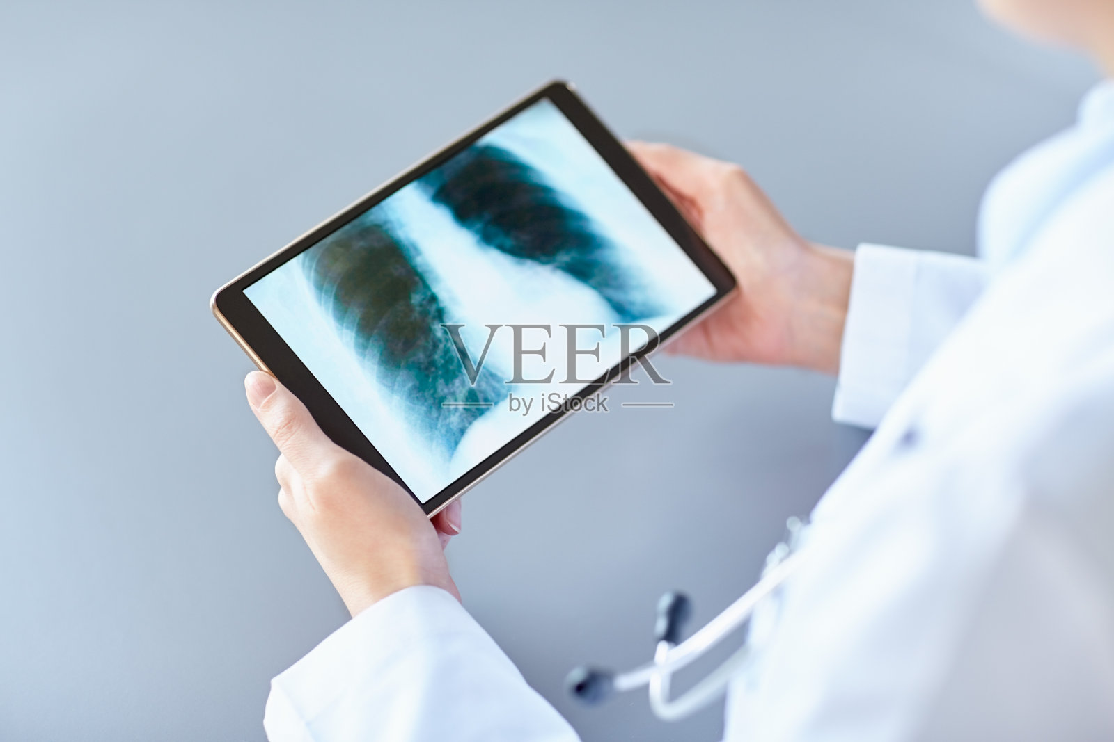 临床医生用数字片分析肺部x线照片摄影图片