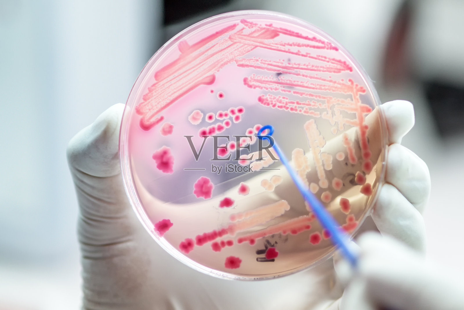 微生物科医院麦康基琼脂上发酵乳糖的粉红色大肠杆菌菌落。照片摄影图片