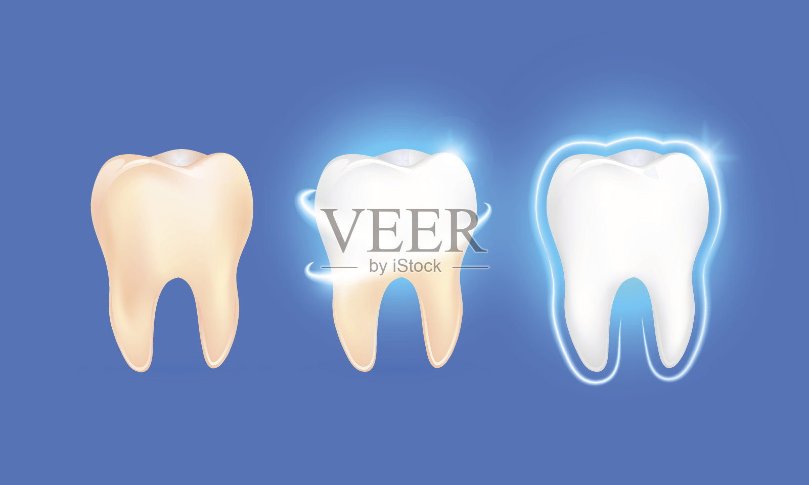 设置干净和脏牙在蓝色背景上，清除牙齿的过程。插画图片素材