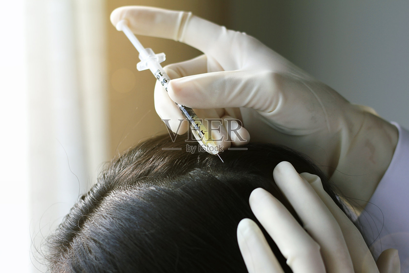 医生注射病人的头发和头皮，近距离拍摄皮肤科医生检查头皮疾病。照片摄影图片