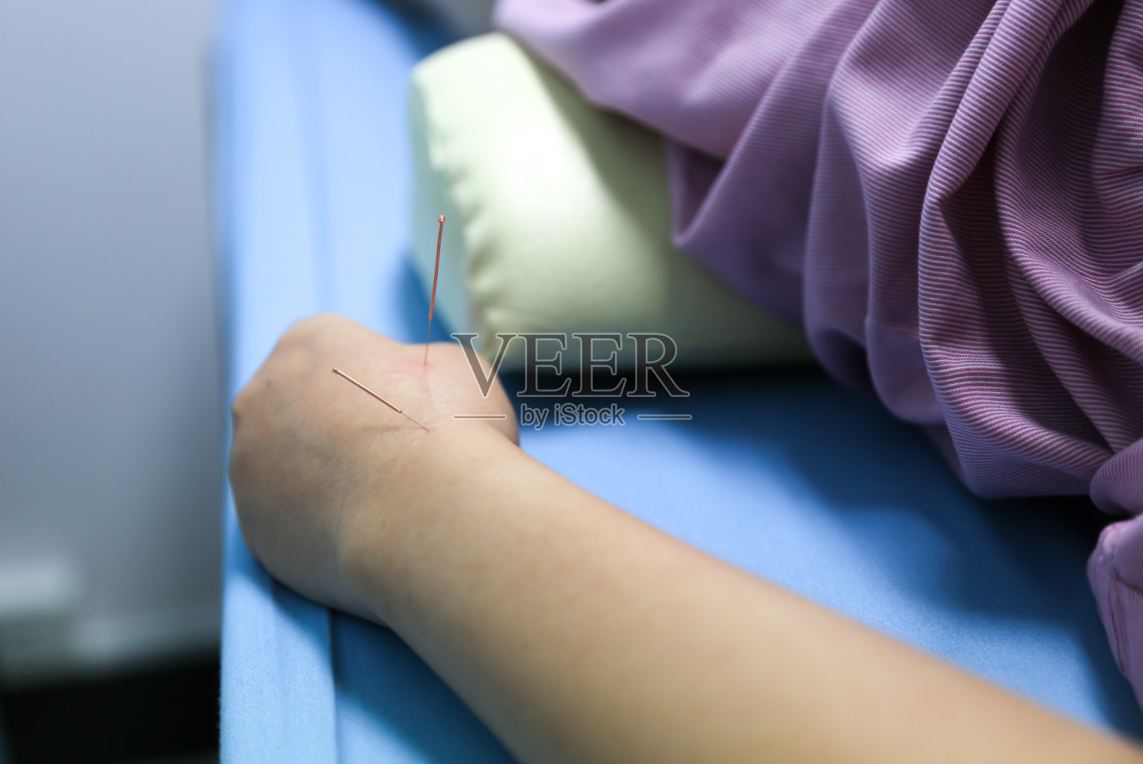 正在接受针灸治疗的妇女的手照片摄影图片