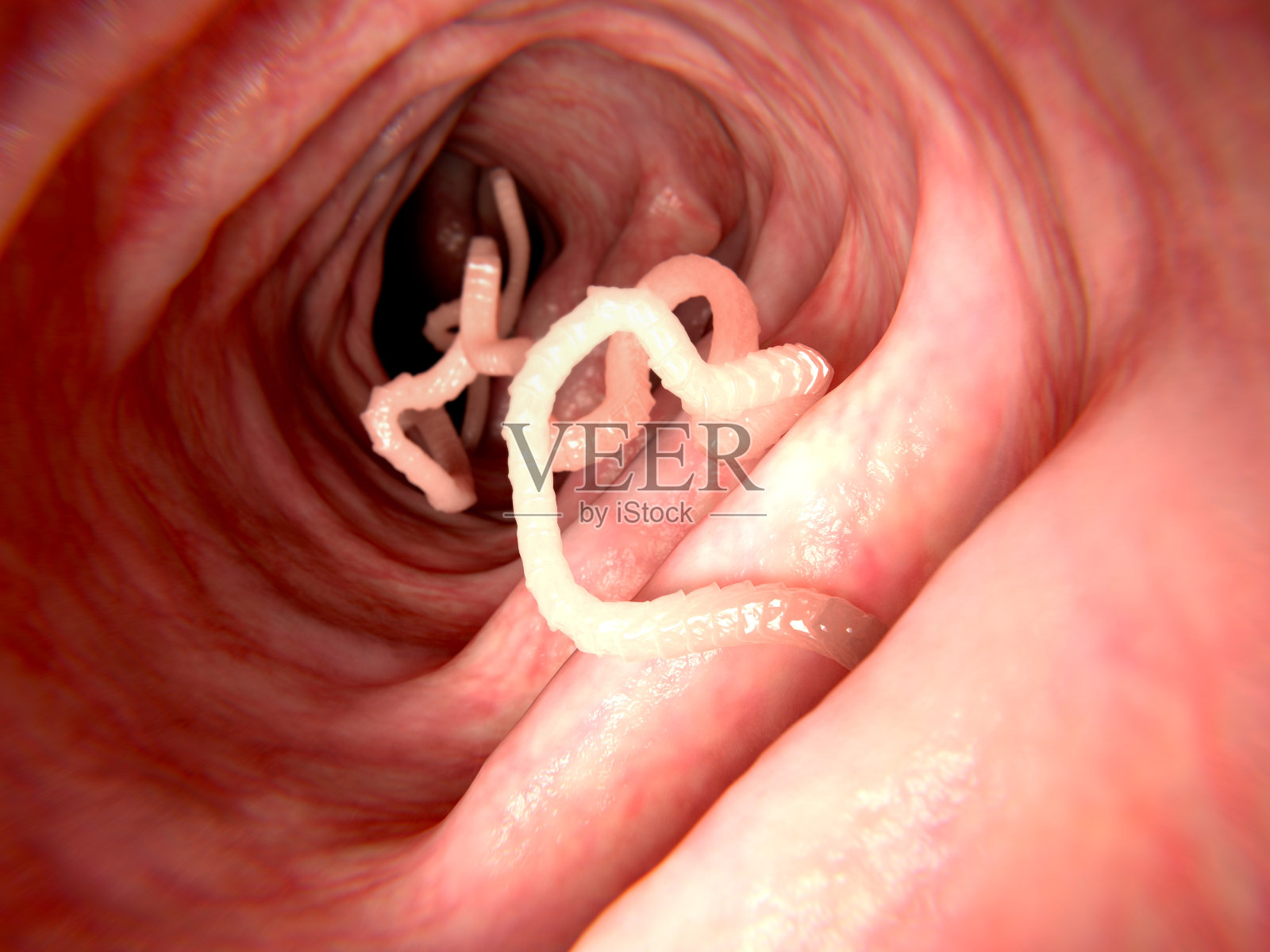 人肠中的绦虫照片摄影图片