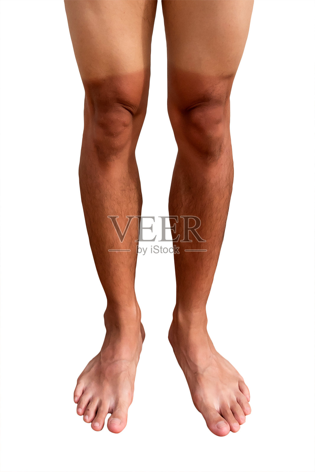 人的腿被晒成两种颜色照片摄影图片