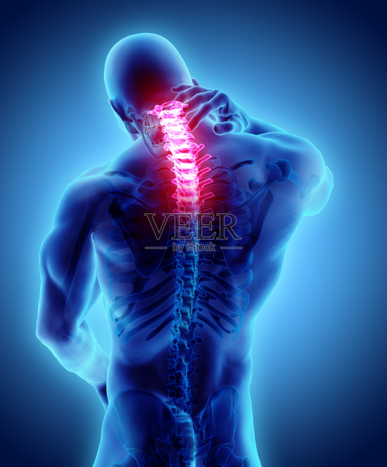 颈部疼痛骨骼x光，3D插图。插画图片素材