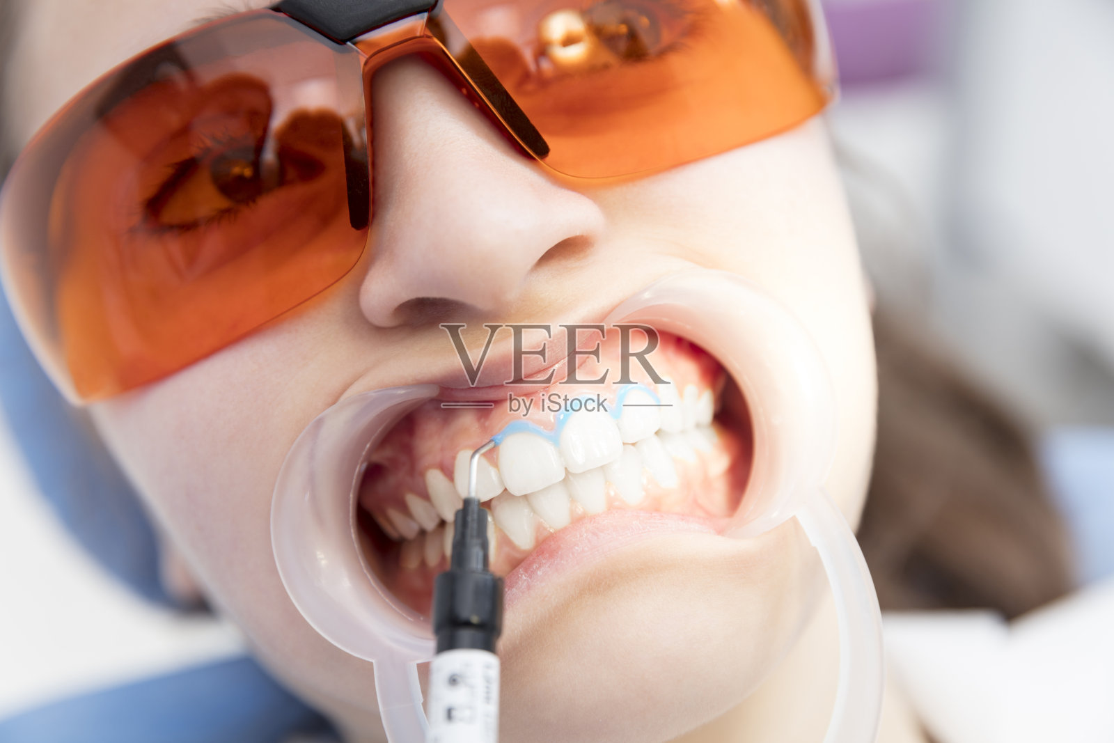接受牙科护理的妇女照片摄影图片