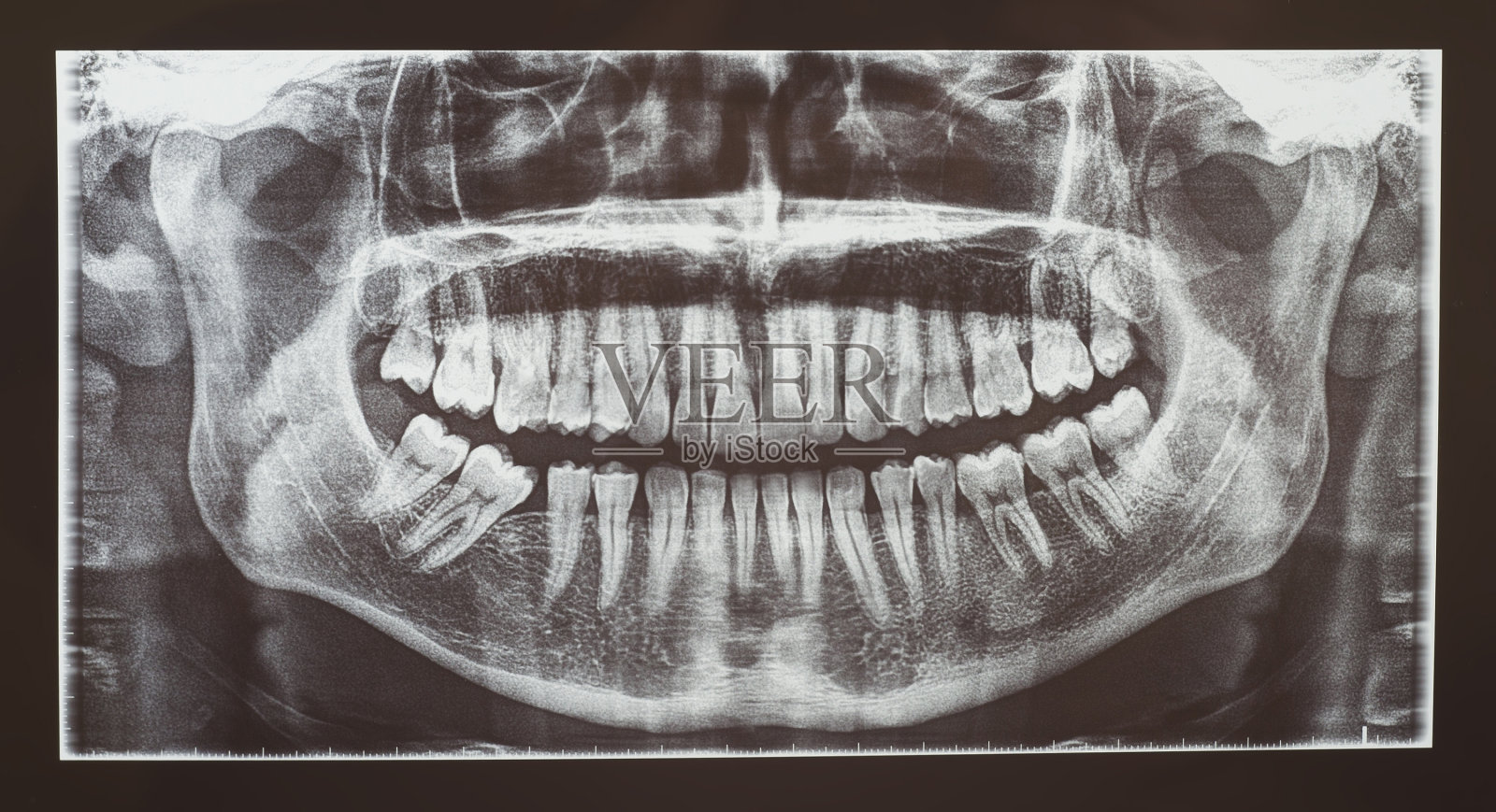 牙科放射医学或牙科放射学照片摄影图片