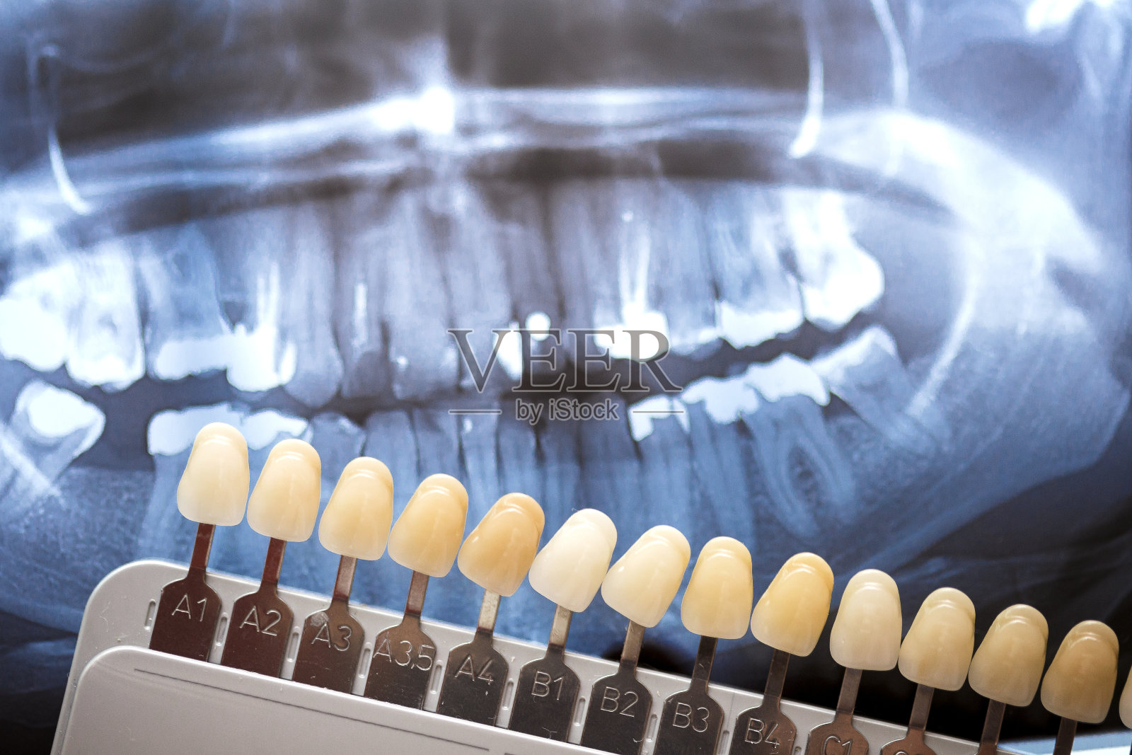 牙科医生用x光检查牙齿照片摄影图片