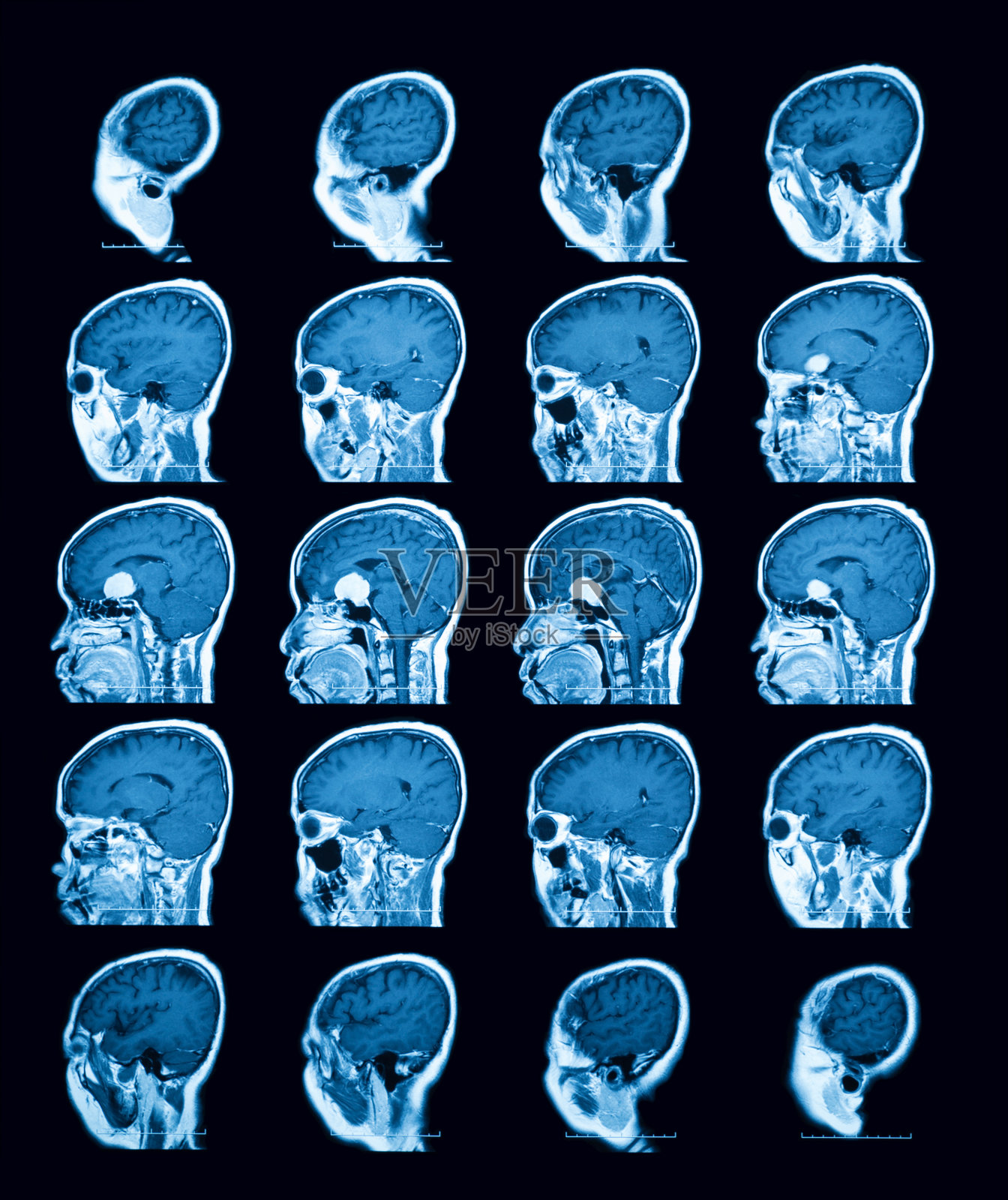 磁共振成像(MRI)扫描大脑，矢状面。照片摄影图片