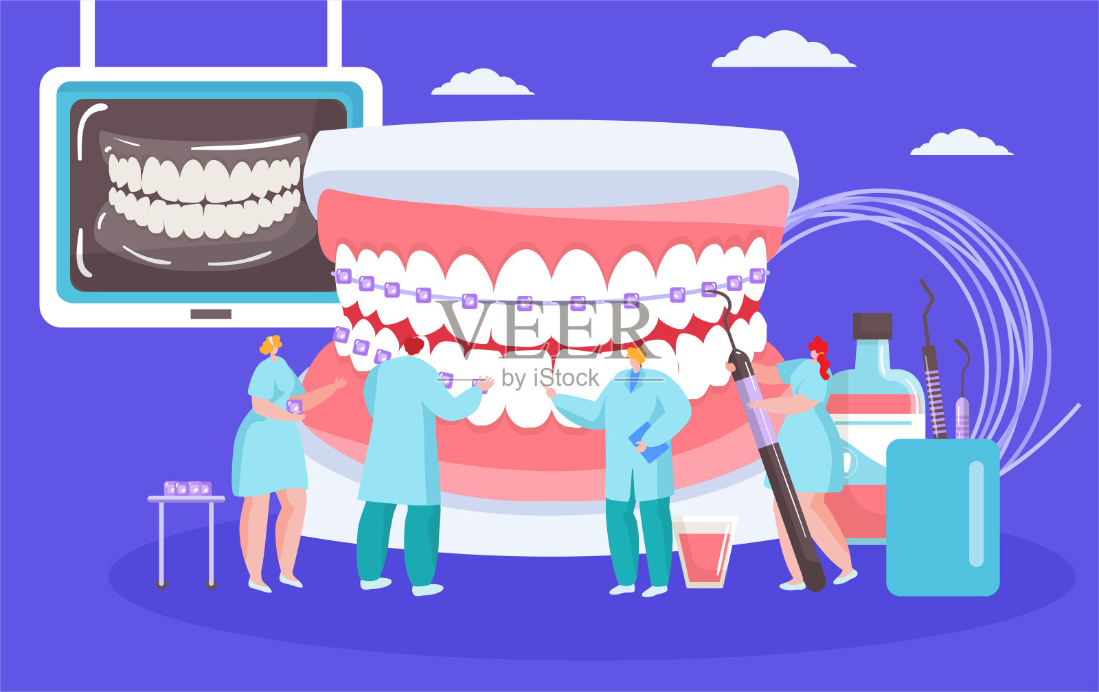安装牙套矢量插图与牙医迷你人与巨大的口腔正畸概念。插画图片素材