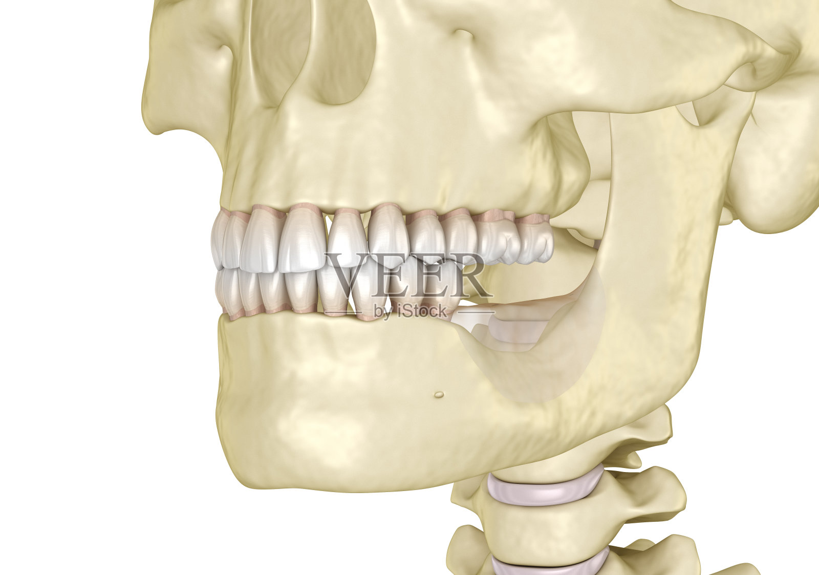 下颌骨，骨质衰退后失去磨牙牙齿。医学上准确的牙科3D插图照片摄影图片